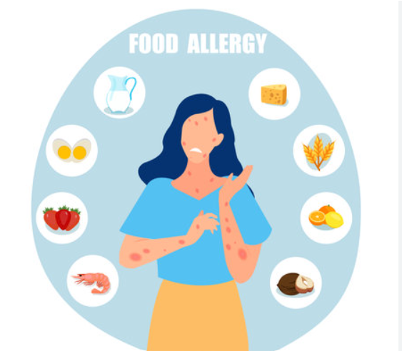 Allergen Control &amp; Awareness Training
